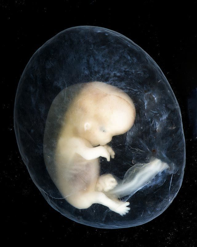جنين في حوالي 8 إلى عشرة أسابيع من عمر الحمل المتوقع